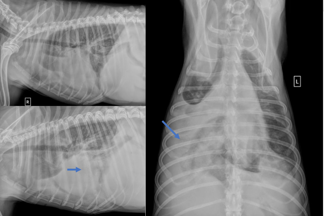 Question du mois : torsion de lobe pulmonaire en imagerie