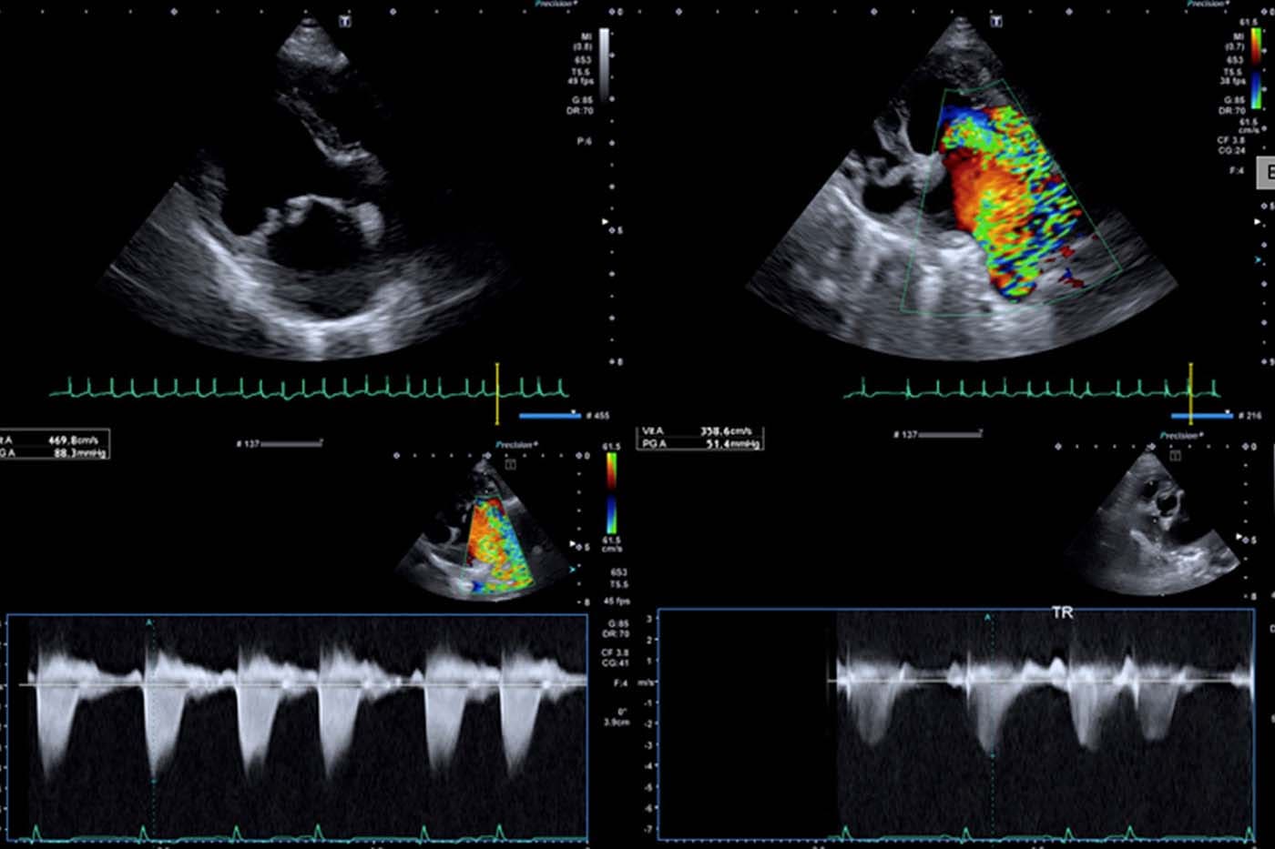 Electrocardiologie