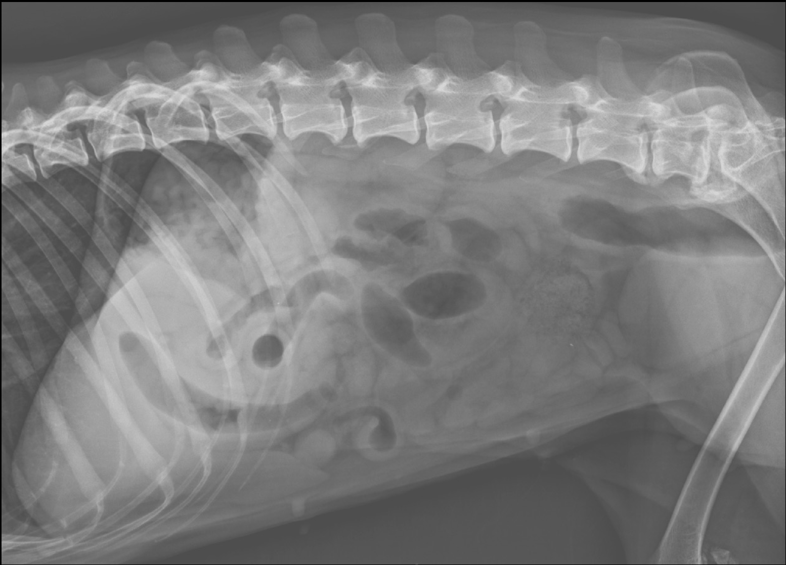 Radiographies abdominales, quel est votre diagnostic?