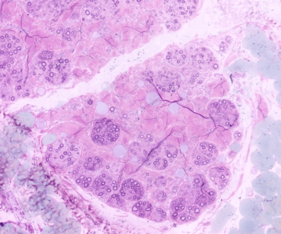 Cas de polyneuropathie chez un chien