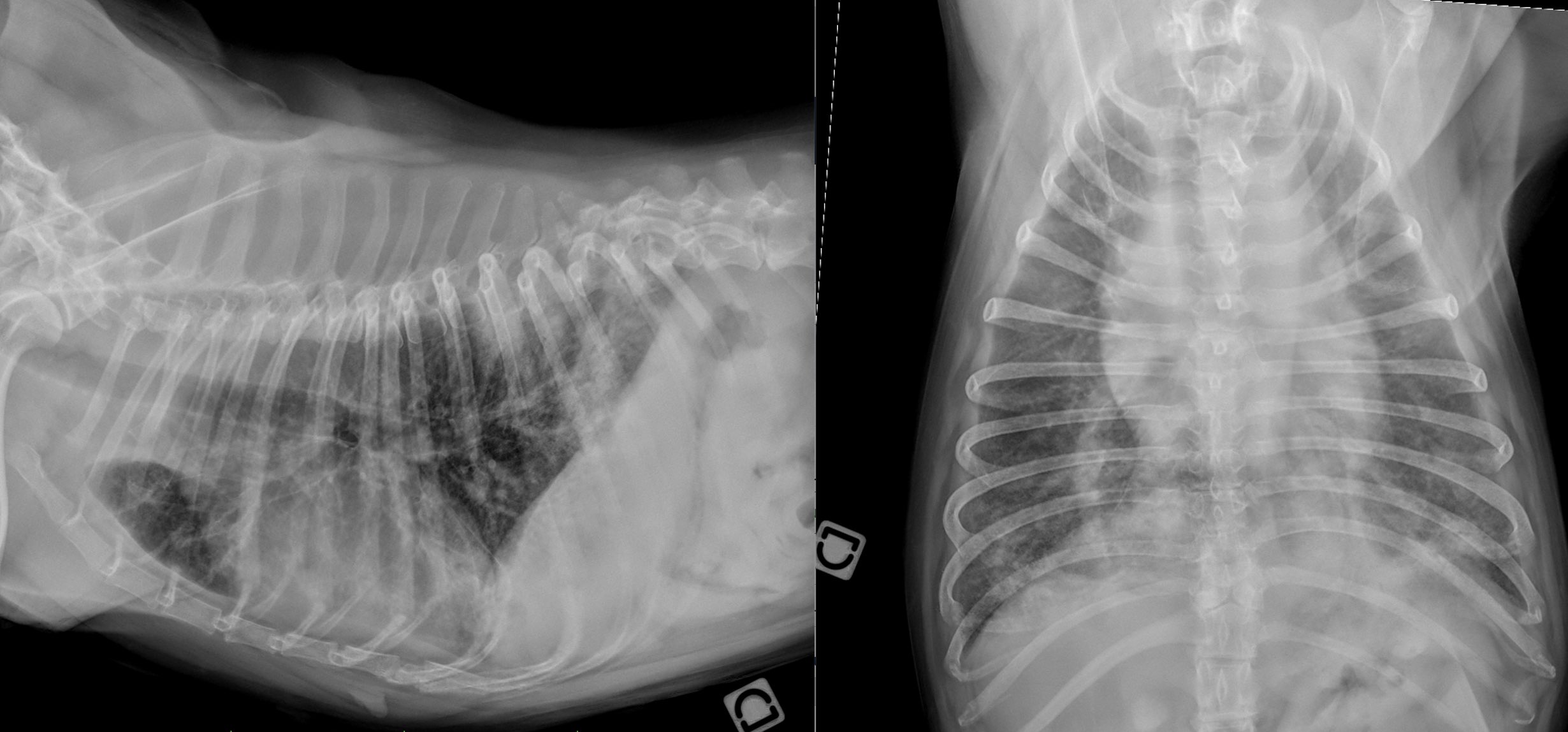 Reconnaître les types d’opacification pulmonaire