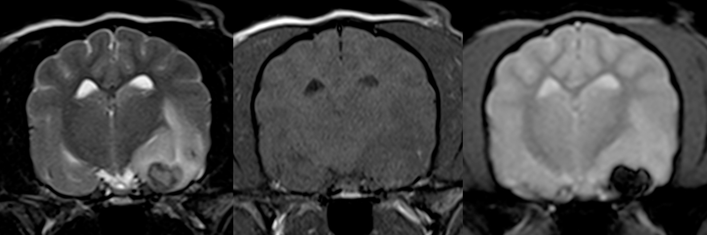 Quelle démarche diagnostique lors d’AVC ?