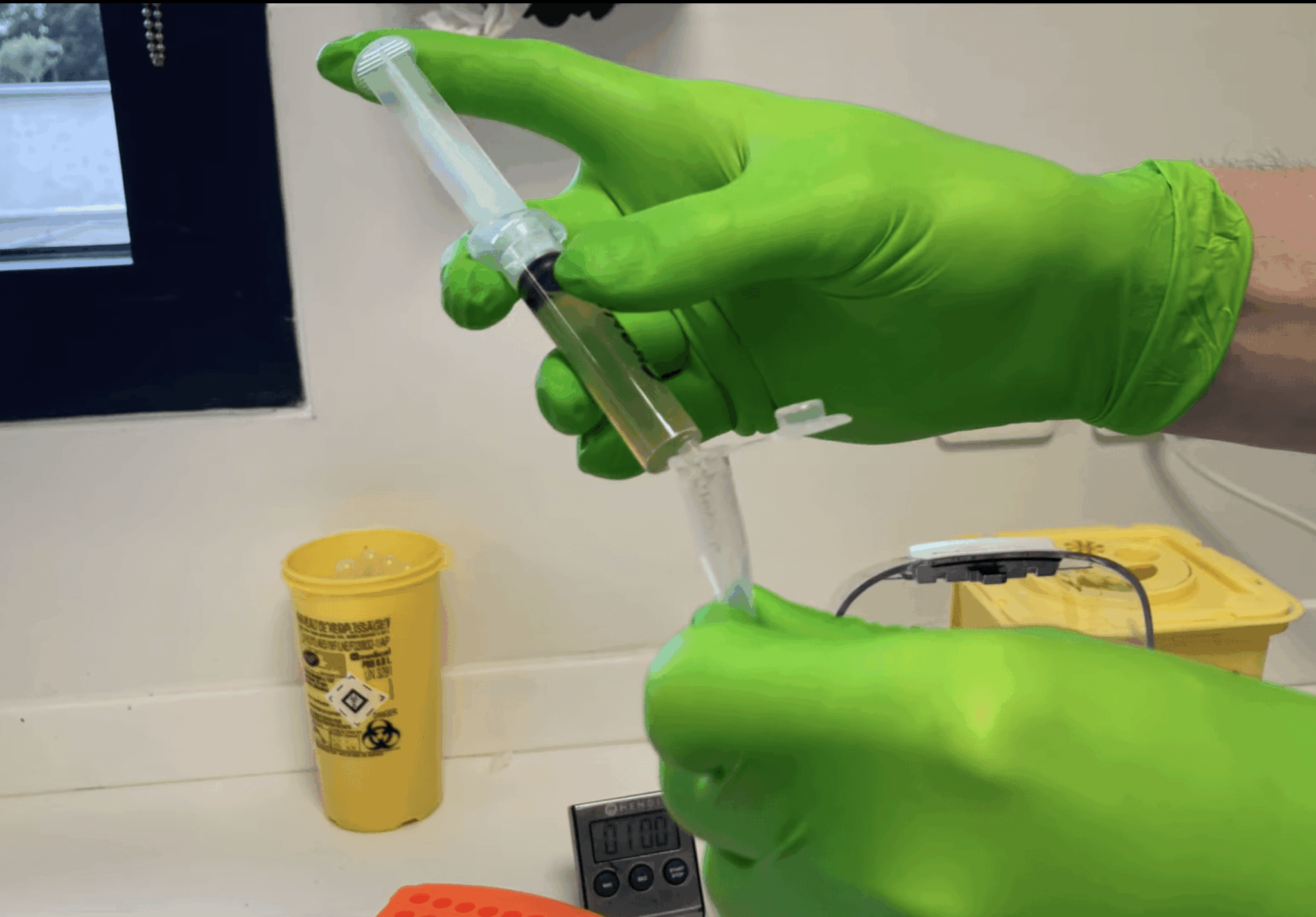 Réaliser un culot urinaire