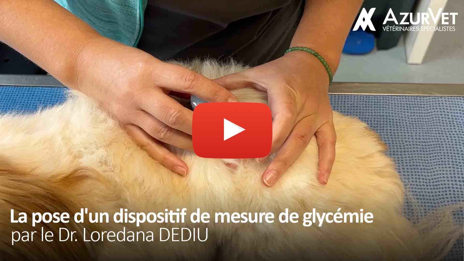 Comment réaliser la pose d&rsquo;un dispositif de mesure de glycémie