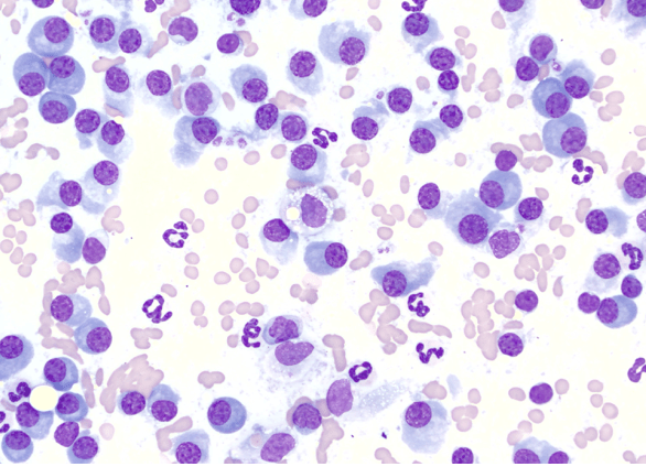 Cytologie de masse cutanée