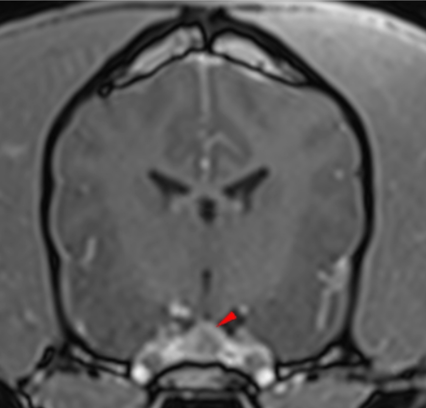 Imagerie lors de tumeur hypophysaire